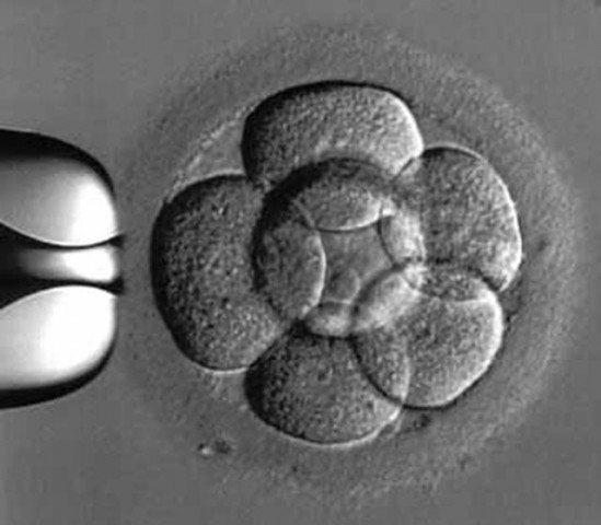 photo advanced fertility photo advanced fertility