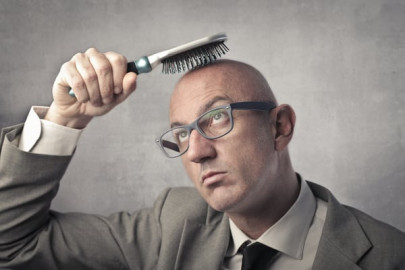 6 methods of battling baldness 6 methods of battling baldness