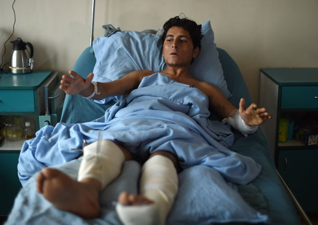 in this photograph taken on november 9 2015 a wounded afghan national army ana soldier gestures after receiving treatment at sardar mohammed daoud khan military hospital in kabul photo afp