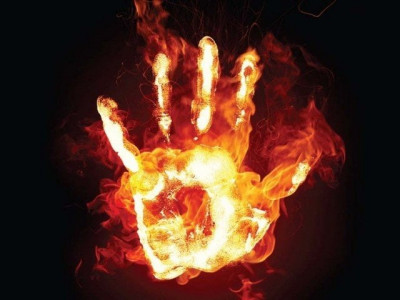 man battles for life after attempted self immolation