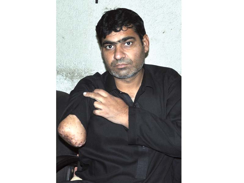 hussain says the loss of his arm has left him financially dependent photo zafar aslam express