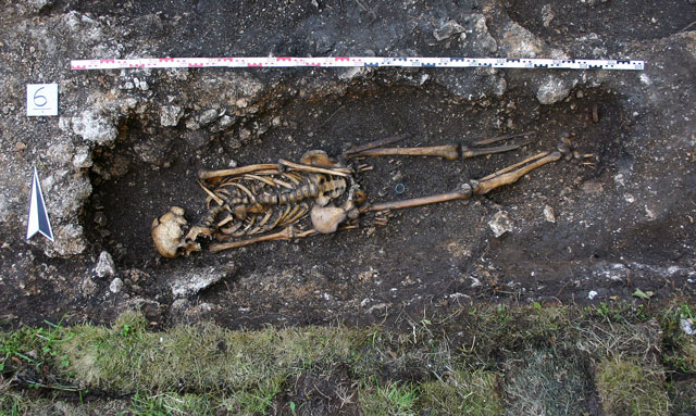 this undated handout picture made available by the austrian archaelogy institute shows a skeleton of a man missing his left foot and ankle and having a prosthetic implant at hemmaberg in southern austria photo afp