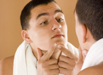 surprising reasons why men get acne surprising reasons why men get acne