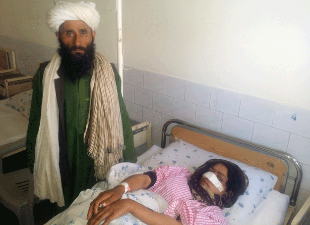 afghan woman reza gul lays in a bed next to an unidentified relative as she receives treatment at a hospital in the northern province of faryab on january 20 2016 photo afp