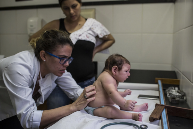 a pediatrician checks up on 9 week old luhandra born with microcephaly a condition of abnormal brain development at a public hospital in brazil photo washington post a pediatrician checks up on 9 week old luhandra born with microcephaly a condition of abnormal brain development at a public hospital in brazil photo washington post