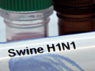 h1n1 influenza bears similarities to average flu and can only be diagnosed through laboratory tests photo afp