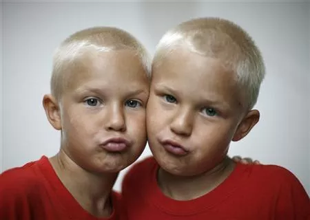 identical twin brothers mason l and hudson forsyth from toronto ontario are pictured before taking part in a look alike contest during the final day of the 32nd annual twins days festival in twinsburg ohio august 5 2007 photo reuters identical twin brothers mason l and hudson forsyth from toronto ontario are pictured before taking part in a look alike contest during the final day of the 32nd annual twins days festival in twinsburg ohio august 5 2007 photo reuters