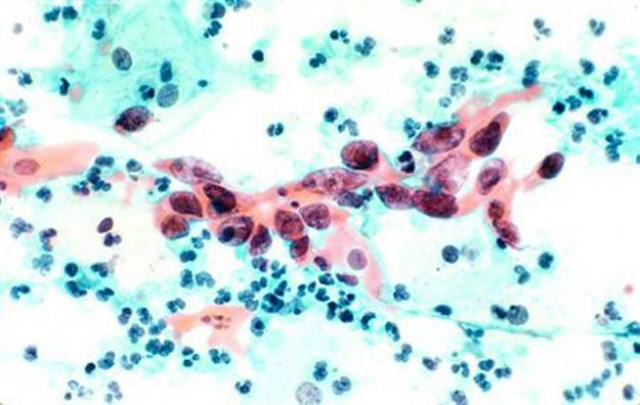 the disease has a 60 per cent fatality rate photo reuters the disease has a 60 per cent fatality rate photo reuters
