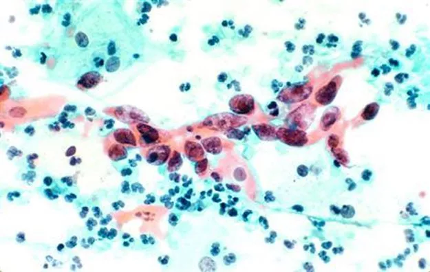 the disease has a 60 per cent fatality rate photo reuters the disease has a 60 per cent fatality rate photo reuters