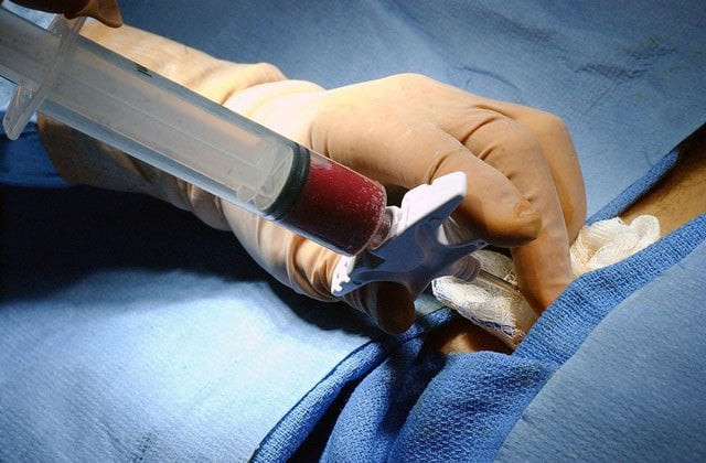 prof dr tahir shamsi will coordinate with the institute s management to finalise the arrangements for the first ever bone marrow transplantation in the punjab as punjab chief minister shahbaz sharif has sought his assistance in establishing a bone marrow centre in the province photo file