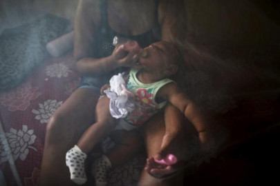 zika link to birth defects could be proven within weeks who zika link to birth defects could be proven within weeks who