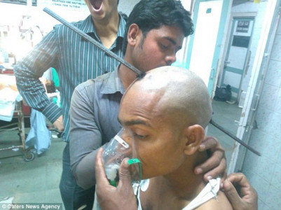 indian worker miraculously survives after 7 foot long iron rod pierces skull