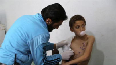 syria ceasefire brings respite to overworked medics syria ceasefire brings respite to overworked medics