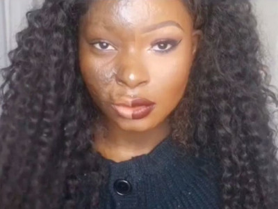 burn survivor sends empowering message through make up burn survivor sends empowering message through make up