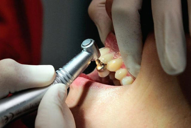 the dentist ripped out healthy teeth and left dozens of patients in a remote french village with broken jaws photo afp file the dentist ripped out healthy teeth and left dozens of patients in a remote french village with broken jaws photo afp file