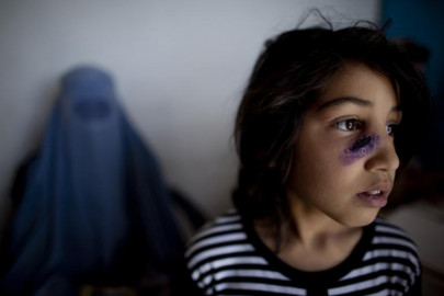 federal govt yet to allow local production of leishmaniasis drug