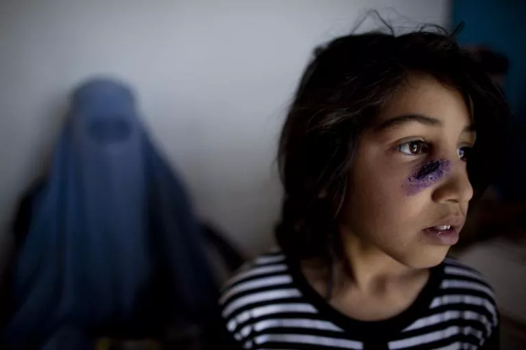 over 5 500 people in k p suffering from epidemic photo afp over 5 500 people in k p suffering from epidemic photo afp