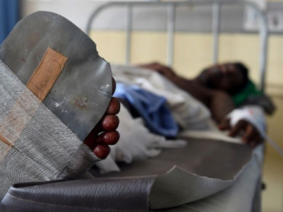 19 year old fighting for life after receiving 100 burns