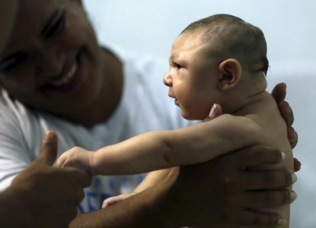 therapist rozely fontoura holds juan pedro who has microcephaly in recife brazil march 26 2016 reuters therapist rozely fontoura holds juan pedro who has microcephaly in recife brazil march 26 2016 reuters