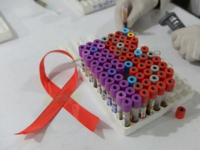 absence of funds aids control programme in k p left abandoned absence of funds aids control programme in k p left abandoned