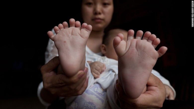 hong hong 039 s mother shows her son 039 s feet the infant was born with 16 toes photo cnn