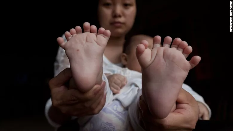 hong hong 039 s mother shows her son 039 s feet the infant was born with 16 toes photo cnn hong hong 039 s mother shows her son 039 s feet the infant was born with 16 toes photo cnn