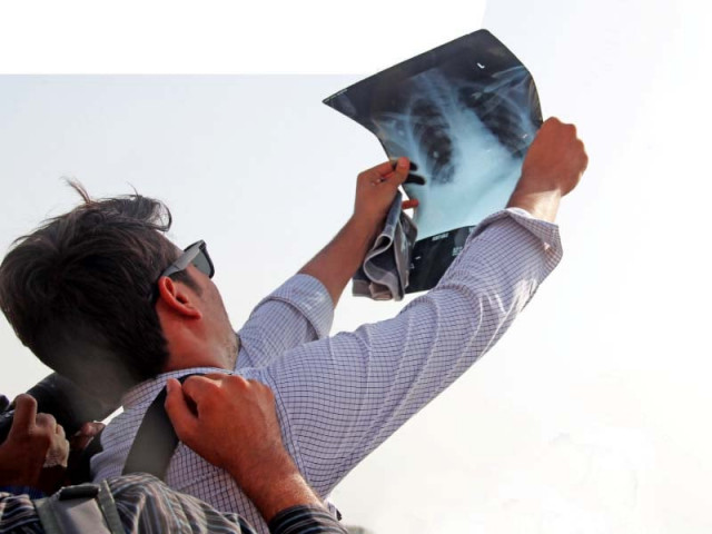 a student uses and x ray to observe the transit of mercury in front of the sun photo ayesha mir express a student uses and x ray to observe the transit of mercury in front of the sun photo ayesha mir express