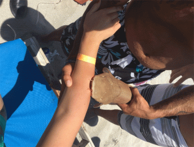 us woman rushed to hospital with shark stuck to arm