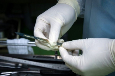 failure to act cmo sacked for refusing to conduct post mortem