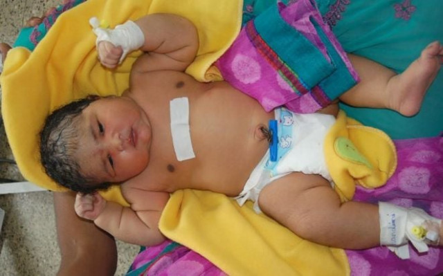 the newborn baby weighs the same as any six month old would normally weigh in india photo courtesy bbc the newborn baby weighs the same as any six month old would normally weigh in india photo courtesy bbc