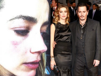 amber heard accuses johnny depp of domestic violence