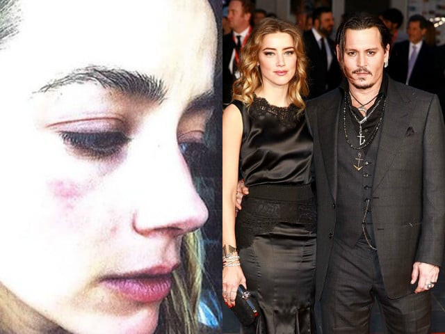 actor submitted a photo of her bruised face to obtain a restraining order against estranged husband actor submitted a photo of her bruised face to obtain a restraining order against estranged husband