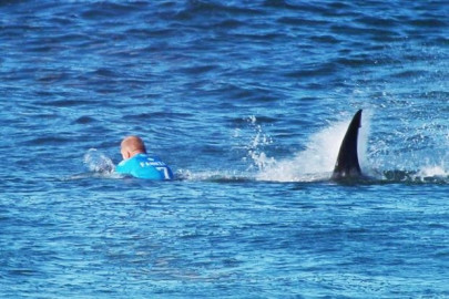 surfer dies after losing leg in australian shark attack
