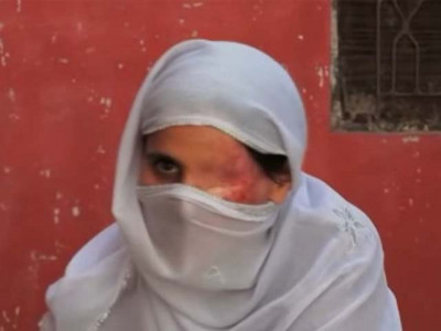 saving face a masterpiece documentary