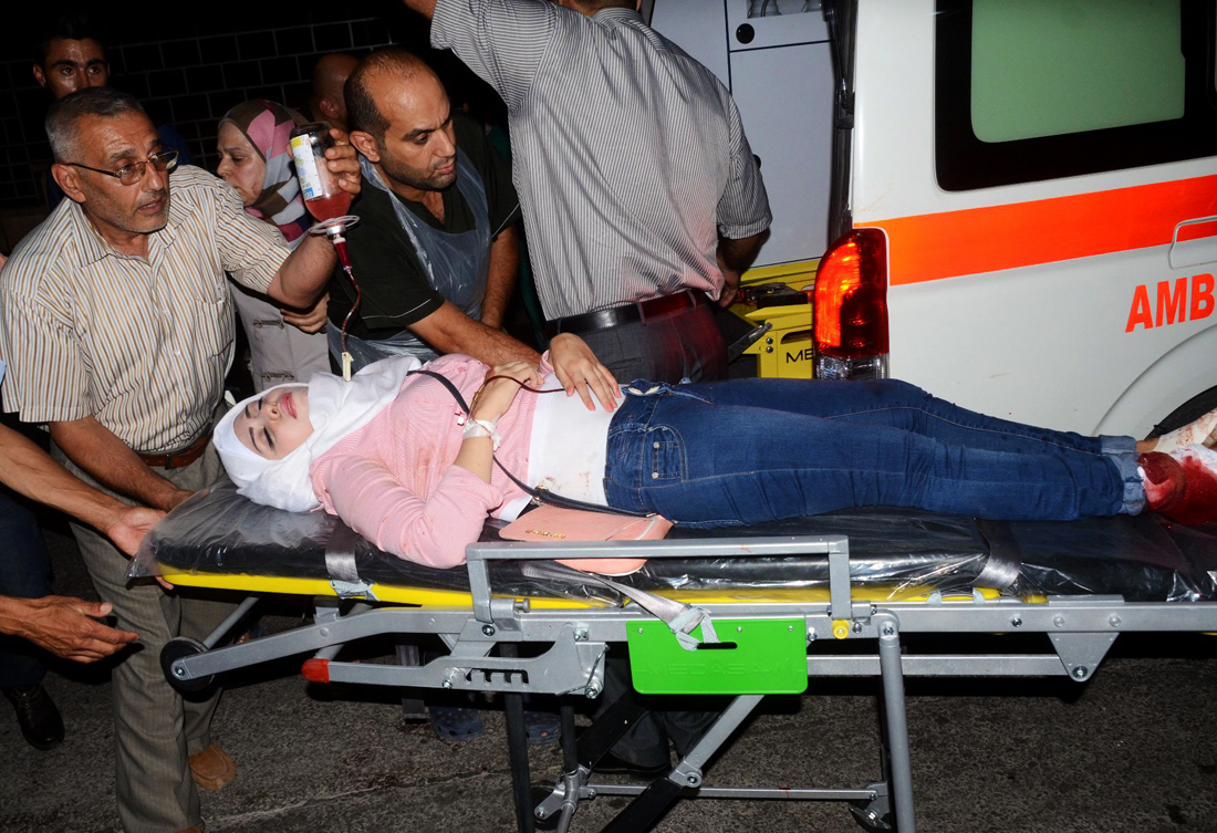 a syrian woman who was wounded following reported shelling by rebel fighters arrives on a stretcher to a hospital in the al jamiliyah neighbourhood on the government controlled side of the divided northern city of aleppo on july 8 2016 photo afp