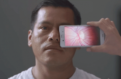 this smartphone app helps cure blindness in poor countries this smartphone app helps cure blindness in poor countries