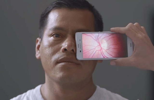 there are 39 million blind people globally photo peek there are 39 million blind people globally photo peek