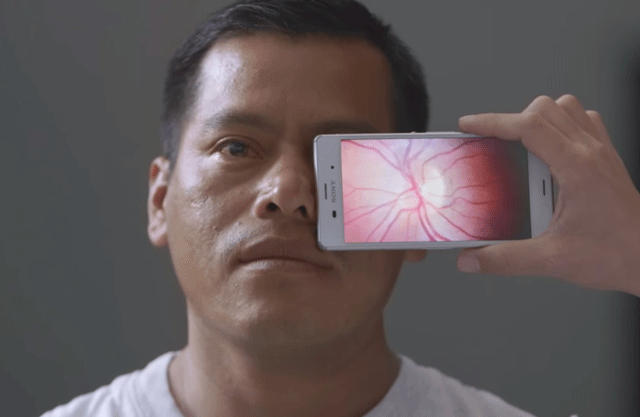 there are 39 million blind people globally photo peek there are 39 million blind people globally photo peek