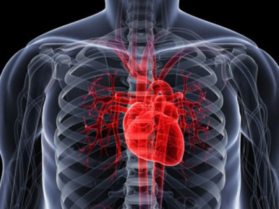 pre stroke lifestyle tied to long term risk of more strokes dementia