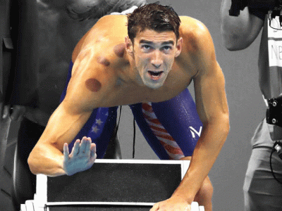 did you know cupping is actually an islamic practice did you know cupping is actually an islamic practice