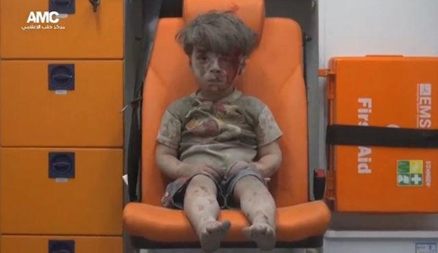 a boy with bloodied face sitting in an ambulance after an airstrike syria photo social media