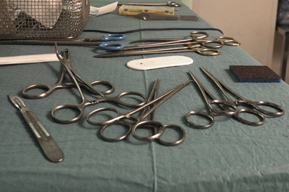 peshawar doctors remove hair clips pins from patient s stomach peshawar doctors remove hair clips pins from patient s stomach