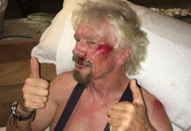 richard branson gives a thumbs up showing injuries after a biking accident on virgin gorda in the british virgin islands in the caribbean photo afp richard branson gives a thumbs up showing injuries after a biking accident on virgin gorda in the british virgin islands in the caribbean photo afp