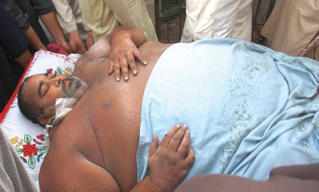 obesity threatens 270kg pakistani man s life