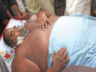 270 kg man struggles on ventilator 270 kg man struggles on ventilator
