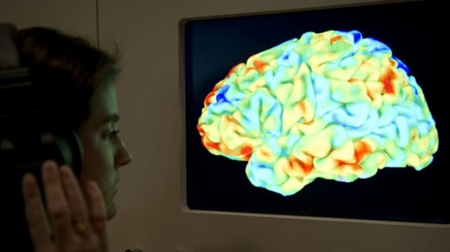 the brains could help uncover new discoveries in biological psychiatry science photo afp the brains could help uncover new discoveries in biological psychiatry science photo afp