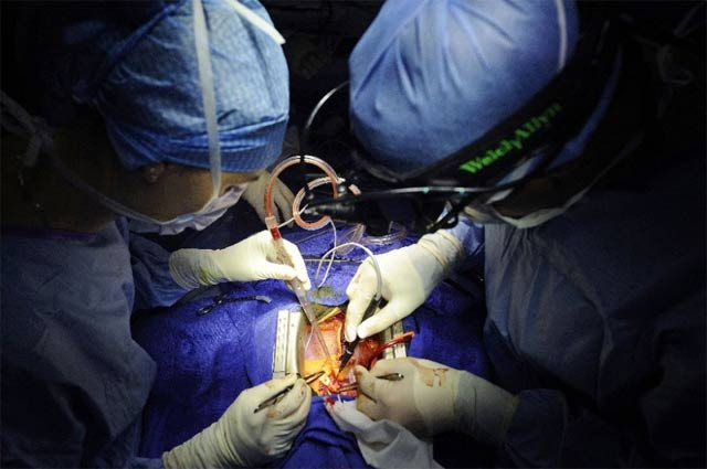 the procedure a first of its kind in performed in the country was conducted by a team of pakistani doctors photo afp the procedure a first of its kind in performed in the country was conducted by a team of pakistani doctors photo afp