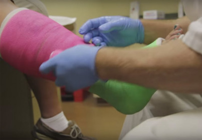 synthetic 3d printed material helps bones regrow