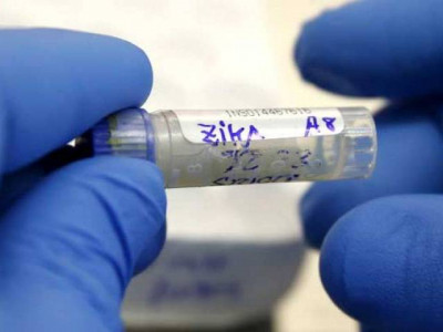 thailand confirms two cases of zika linked microcephaly thailand confirms two cases of zika linked microcephaly