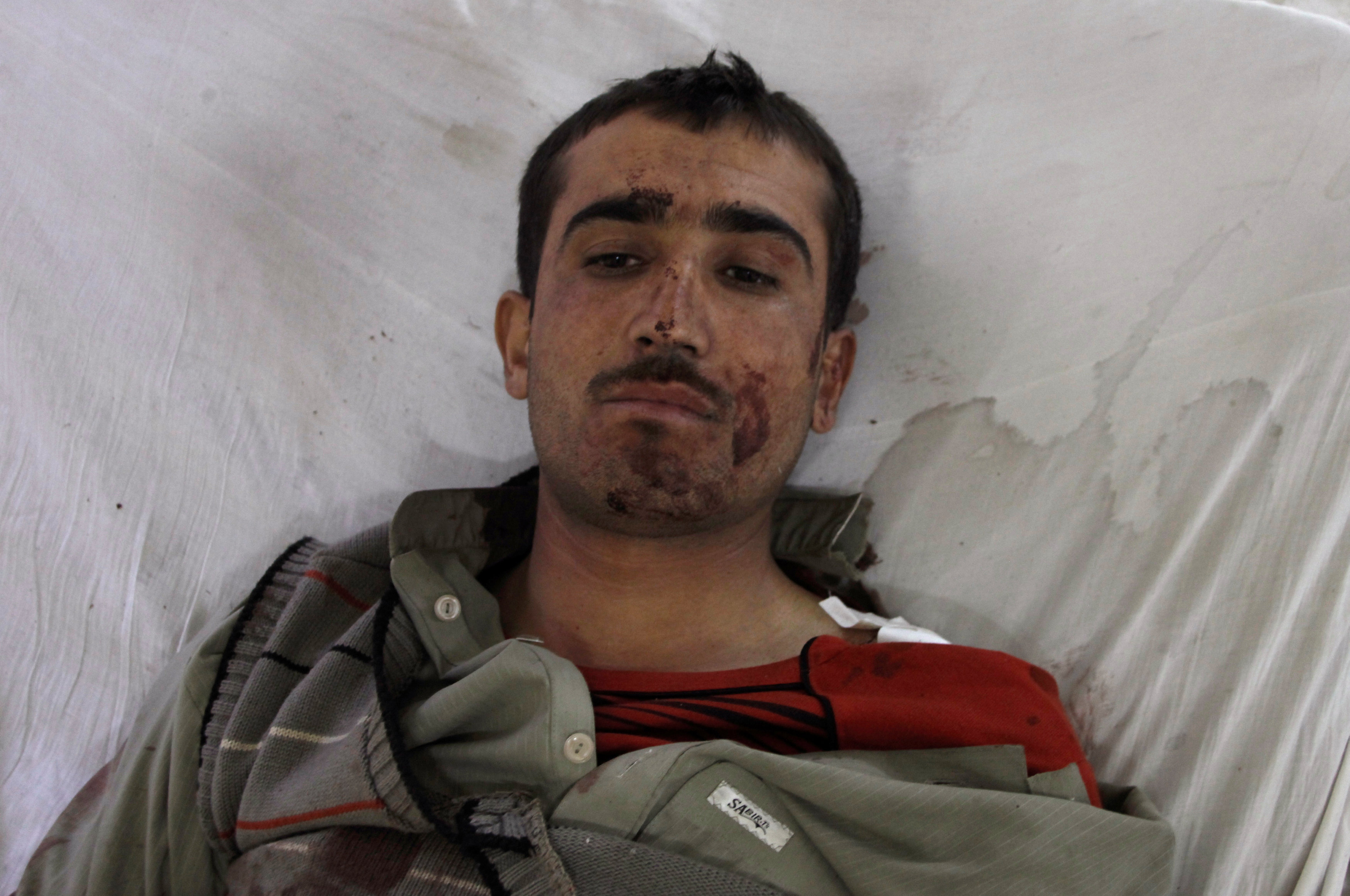 a police cadet from the police training center lies in the hospital after being injured after an attack on the center in quetta pakistan october 25 2016 photo reuters